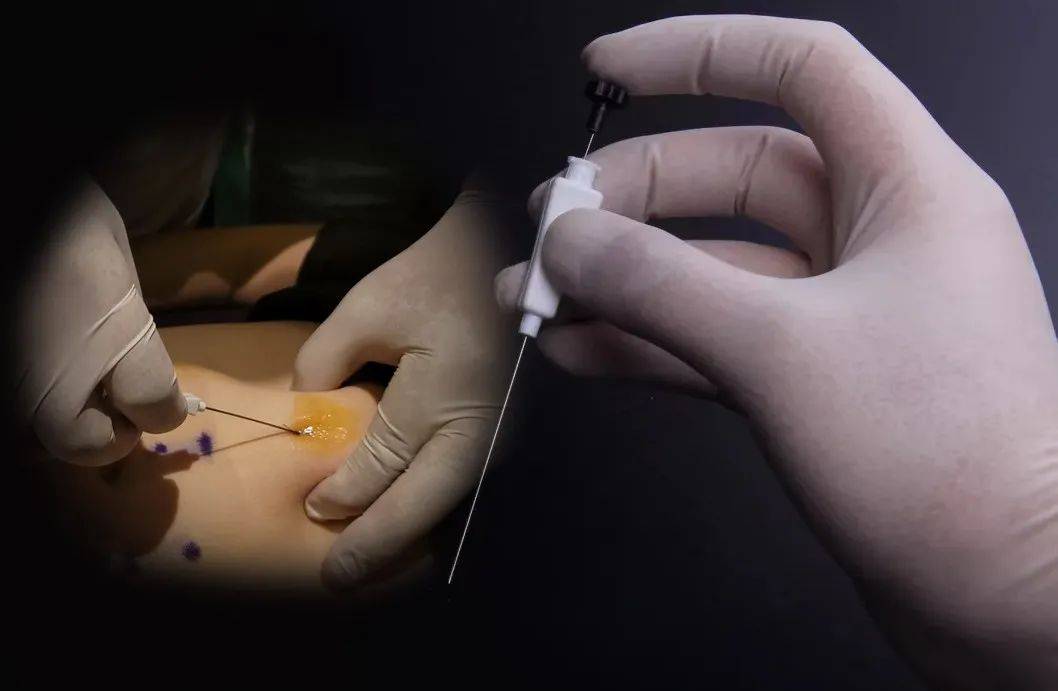 00383c2b92684e918bcfa913e959c896