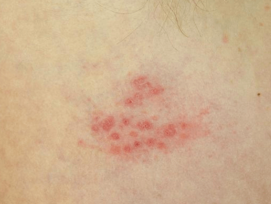 35ae3b1cd4dd481b963d396f4f072938