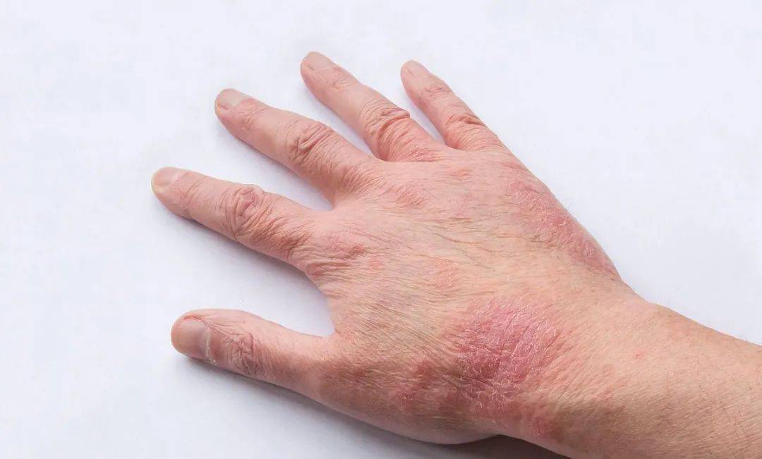 527db50117924a77a72b587b1462a124