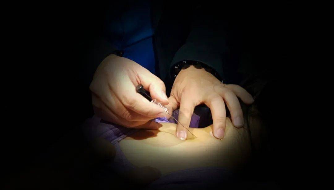 77d0ef73fa134e3b979f7a6655980fcc