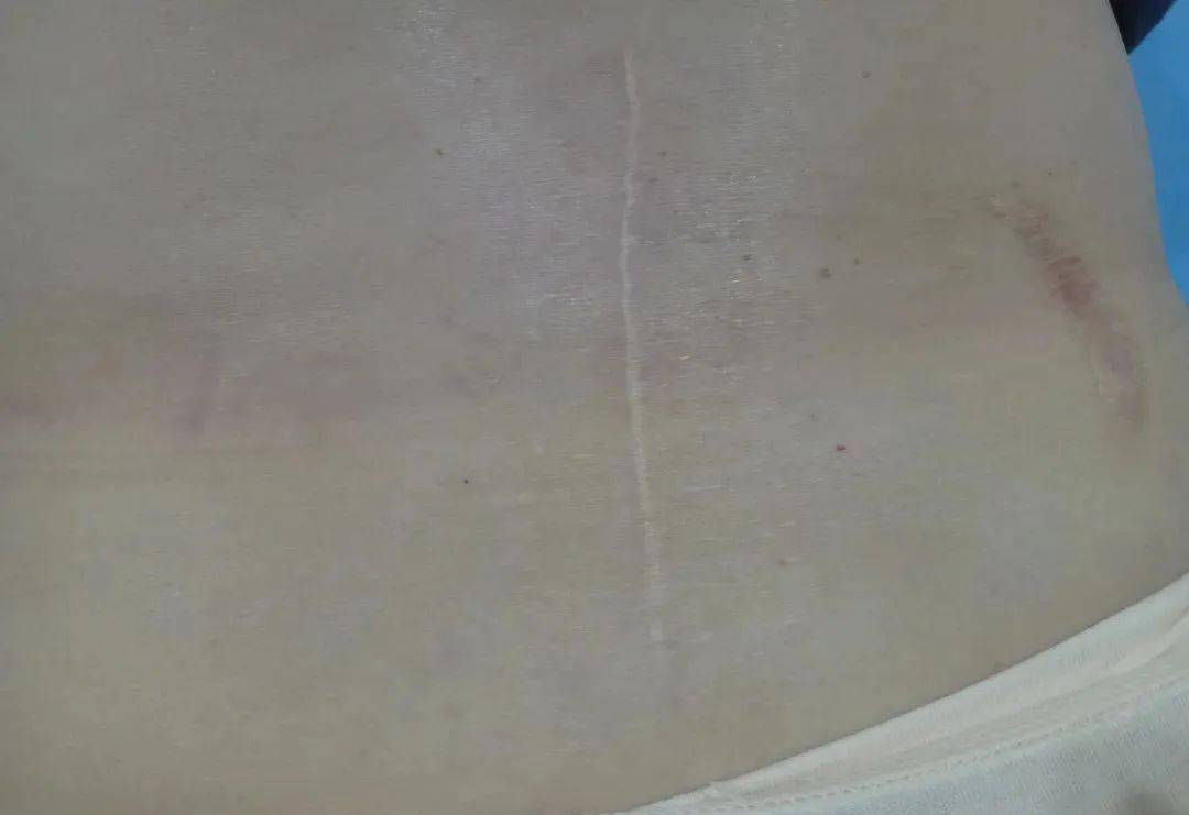 93ce6e68c1524a4ab84554424c099d9b