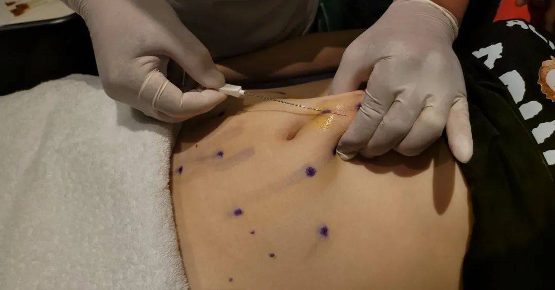 966c32fbc8594584a604fa883a37ea7c