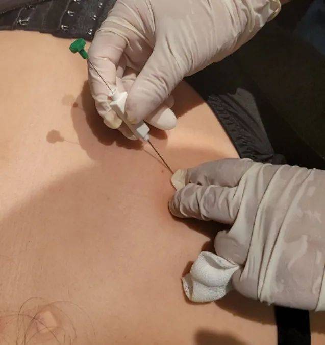 a41576222a58435a940e5edbd6c44e0d