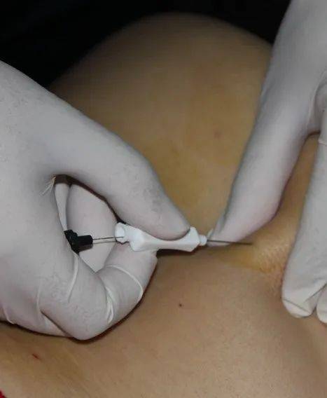 b586bc8115f046a7af7190893d32e449 b586bc8115f046a7af7190893d32e449