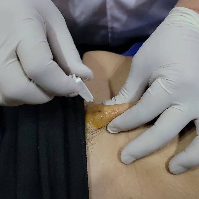 bf45bc86204c42bc8e0111e5779bc8a8