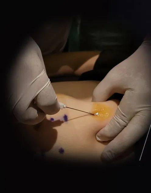 dbdbee758f834d3b95a49ea64579cd6b