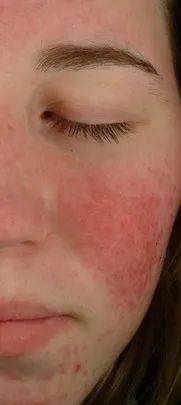 dcc86dae41c24ab5890ab5d5056ce05d