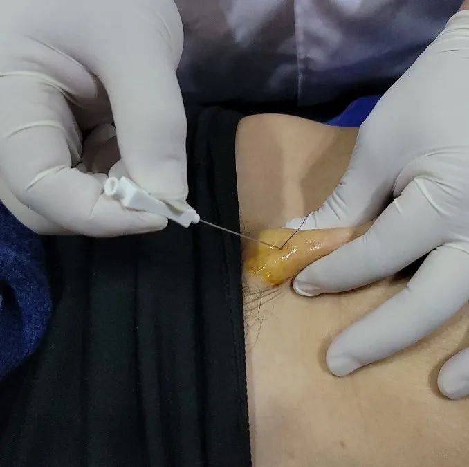 e5b58b5d3648413aad434724320e6a61 e5b58b5d3648413aad434724320e6a61