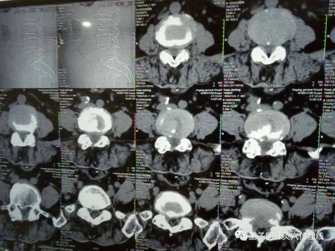 e9ff3008af65401d87b907cb1c834aaa