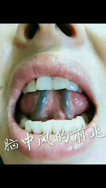 8dee5917eeb647da9babef39ebeabbd5