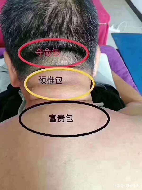 95eef01f3a292df57026034fc144ac6635a8737b.jpeg@f_auto