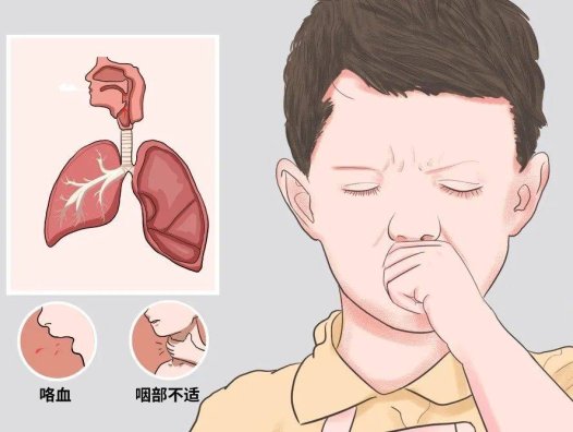 【穴位埋线疗法】——病根埋线治疗小儿反复感冒证的临床经验探讨