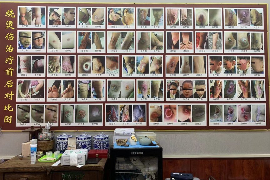 医易和中医专病专治皮肤病终点站